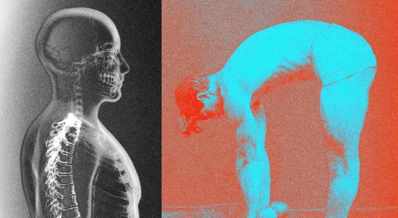 11 back exercises that will improve your posture