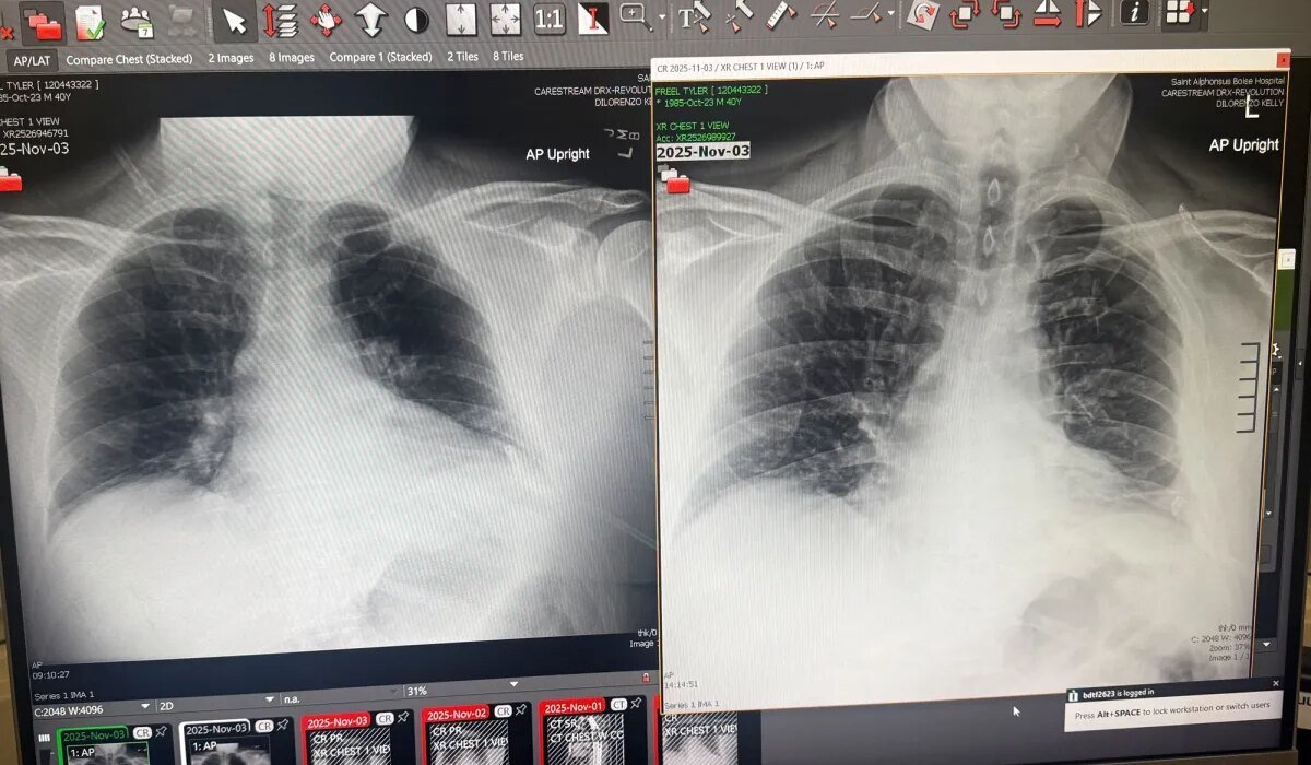 How Not to Die in the Backcountry: According to My Surgeon