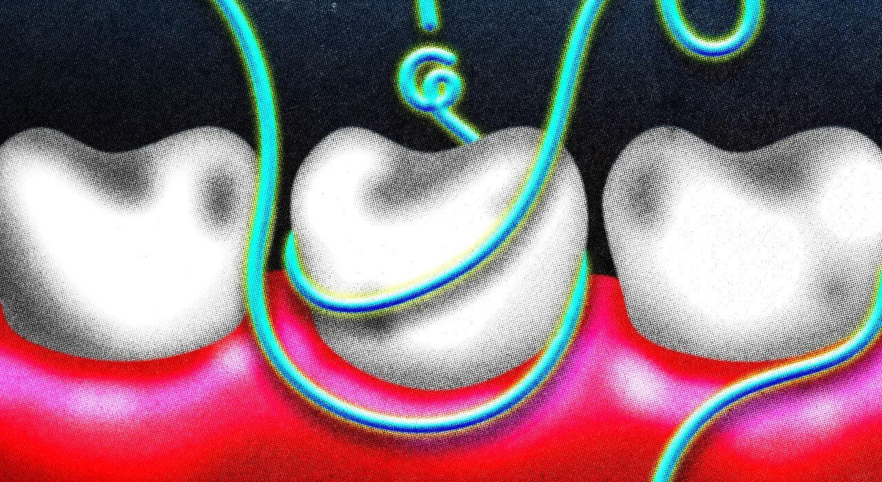 How often should I floss my teeth?