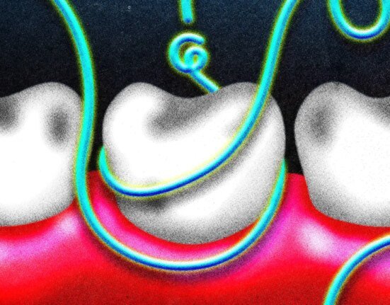 How often should I floss my teeth?