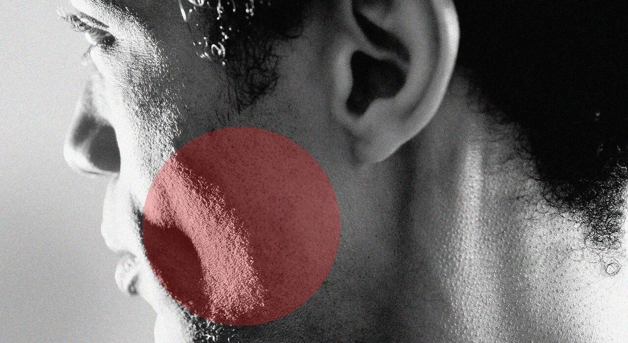 How to treat rosacea according to experts