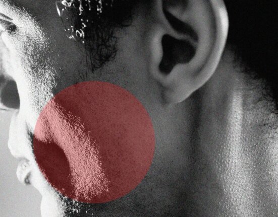 How to treat rosacea according to experts