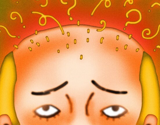 Why am I losing so much hair?