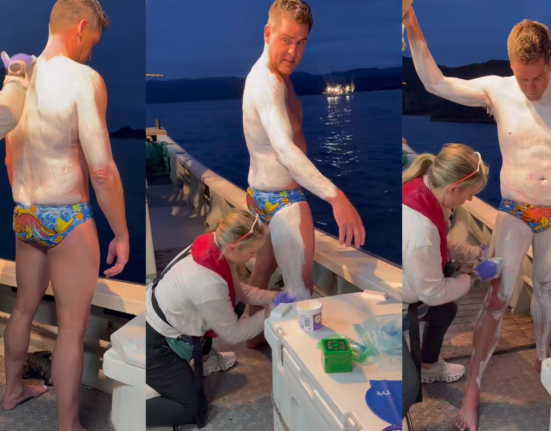 Why this endurance swimmer covered herself in diaper cream and bag balm